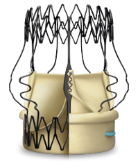 IMPLANTABLES